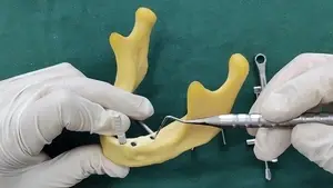 دعامة مائلة لنظام زرعات الأسنان BLE