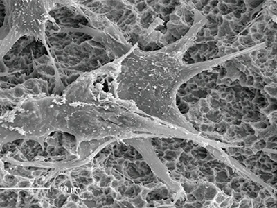 تعزيز التصاق امتدادات الخلايا (Cell Pseudopodia)
